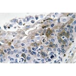 Immunohistochemistry - Anti-IL-1beta Antibody (R12-2204) - Antibodies.com