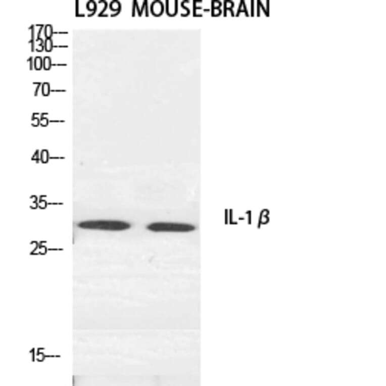Western Blot - Anti-IL-1beta Antibody (R12-2204) - Antibodies.com