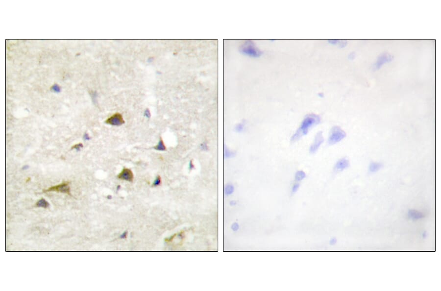 Immunohistochemistry - Anti-IKK-beta Antibody (B0442) - Antibodies.com