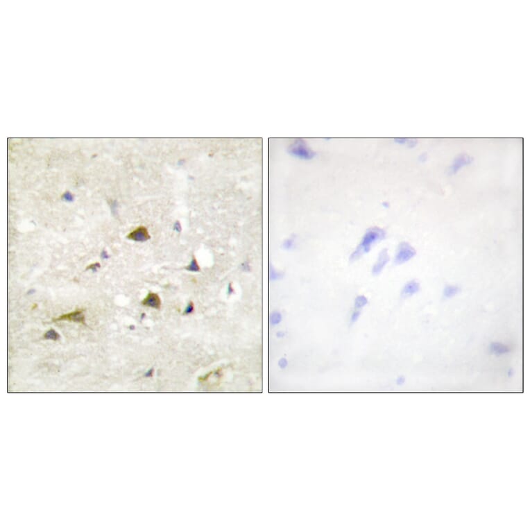 Immunohistochemistry - Anti-IKK-beta Antibody (B0442) - Antibodies.com