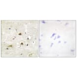 Immunohistochemistry - Anti-IKK-beta Antibody (B0442) - Antibodies.com