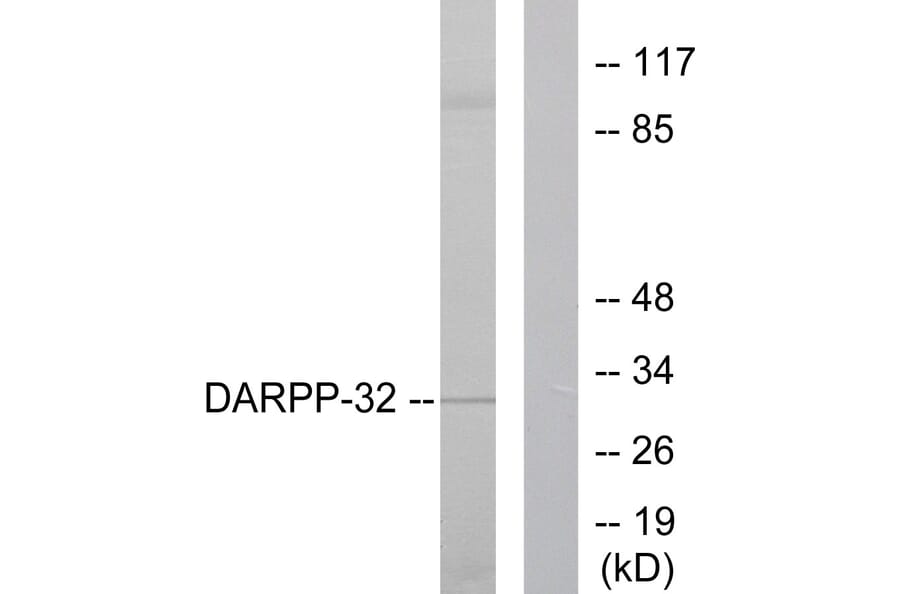 Western Blot - Anti-DARPP-32 Antibody (B0007) - Antibodies.com