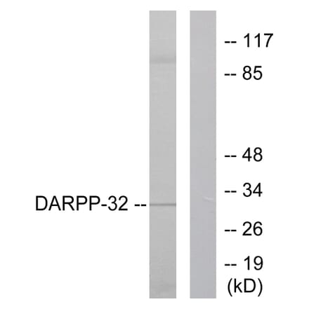 Western Blot - Anti-DARPP-32 Antibody (B0007) - Antibodies.com