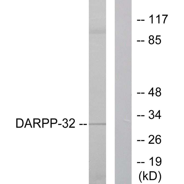 Western Blot - Anti-DARPP-32 Antibody (B0007) - Antibodies.com