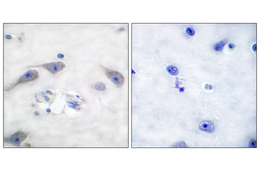 Immunohistochemistry - Anti-DARPP-32 Antibody (B0007) - Antibodies.com