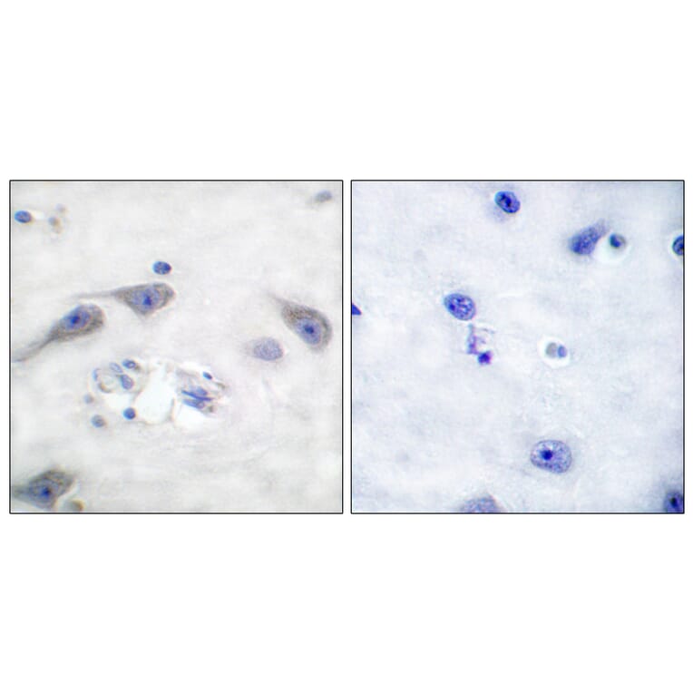 Immunohistochemistry - Anti-DARPP-32 Antibody (B0007) - Antibodies.com