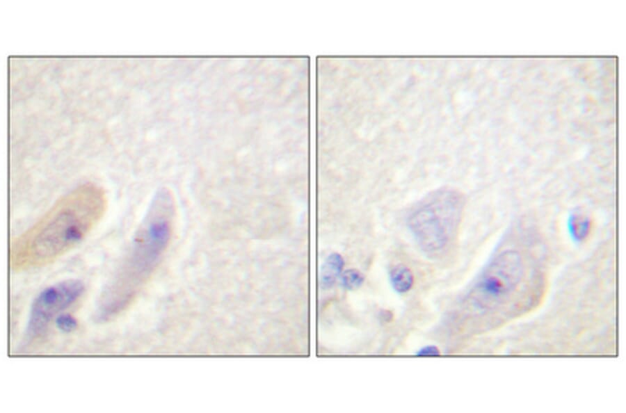 Immunohistochemistry - Anti-DARPP-32 Antibody (B0007) - Antibodies.com