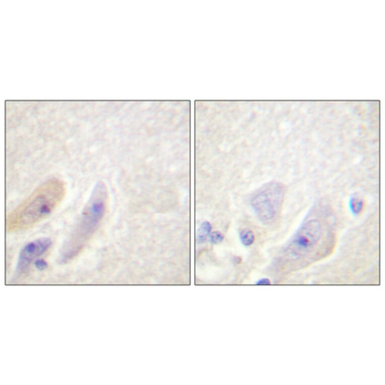 Immunohistochemistry - Anti-DARPP-32 Antibody (B0007) - Antibodies.com