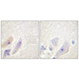 Immunohistochemistry - Anti-DARPP-32 Antibody (B0007) - Antibodies.com