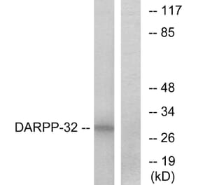 Western Blot - Anti-DARPP-32 Antibody (B7056) - Antibodies.com