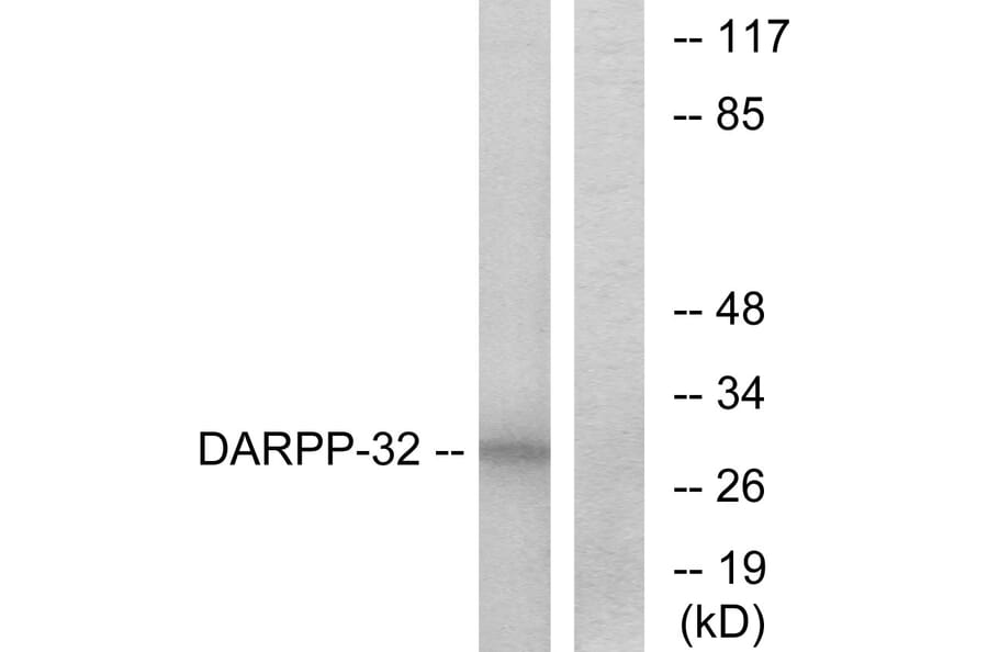 Western Blot - Anti-DARPP-32 Antibody (B7056) - Antibodies.com