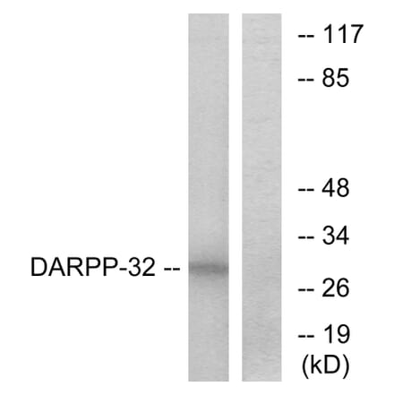 Western Blot - Anti-DARPP-32 Antibody (B7056) - Antibodies.com