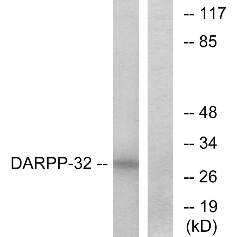 Western Blot - Anti-DARPP-32 Antibody (B7056) - Antibodies.com