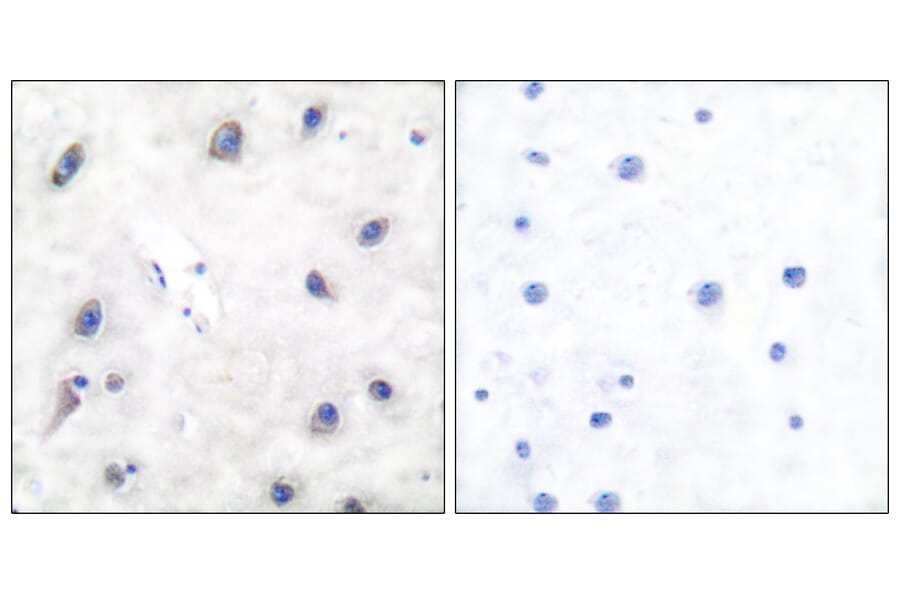 Immunohistochemistry - Anti-DARPP-32 Antibody (B7056) - Antibodies.com