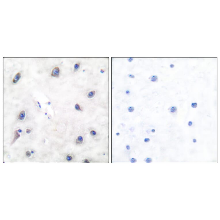 Immunohistochemistry - Anti-DARPP-32 Antibody (B7056) - Antibodies.com