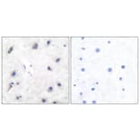 Immunohistochemistry - Anti-DARPP-32 Antibody (B7056) - Antibodies.com