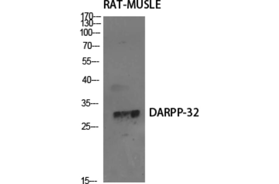 Western Blot - Anti-DARPP-32 Antibody (B7056) - Antibodies.com