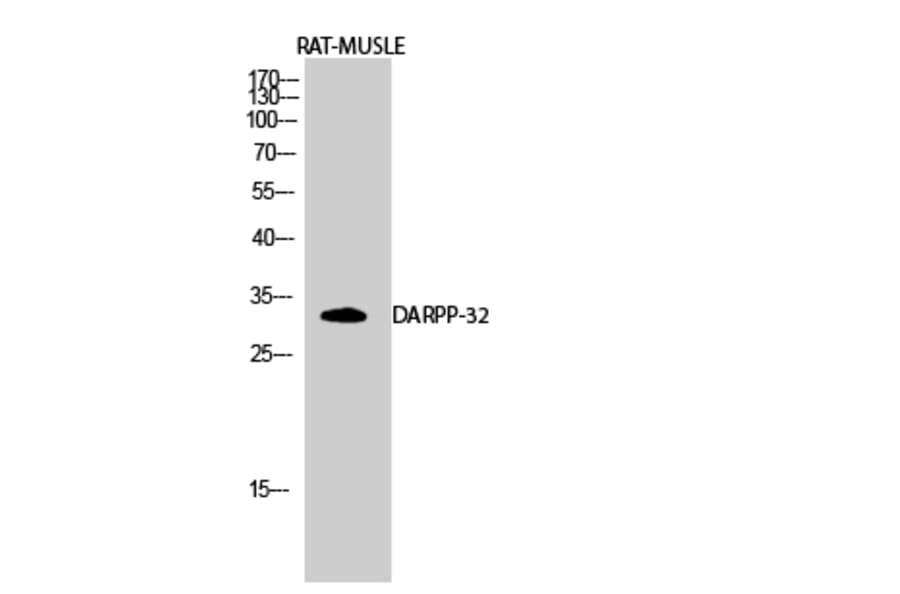 Western Blot - Anti-DARPP-32 Antibody (B7056) - Antibodies.com