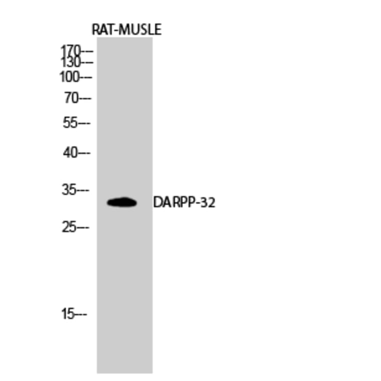 Western Blot - Anti-DARPP-32 Antibody (B7056) - Antibodies.com