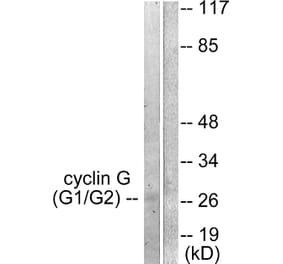 Western Blot - Anti-Cyclin G Antibody (C0169) - Antibodies.com