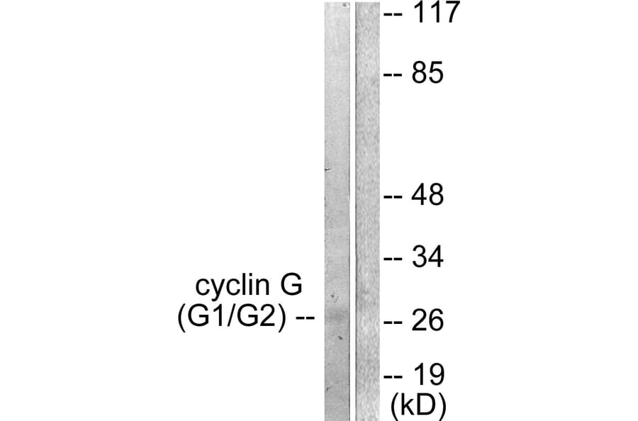 Western Blot - Anti-Cyclin G Antibody (C0169) - Antibodies.com