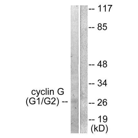 Western Blot - Anti-Cyclin G Antibody (C0169) - Antibodies.com