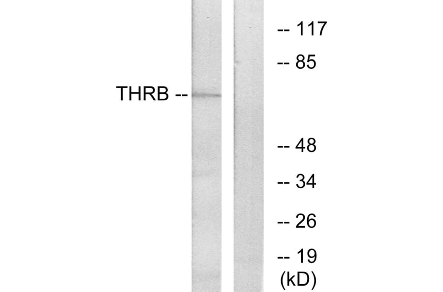 Western Blot - Anti-THRB Antibody (C10260) - Antibodies.com