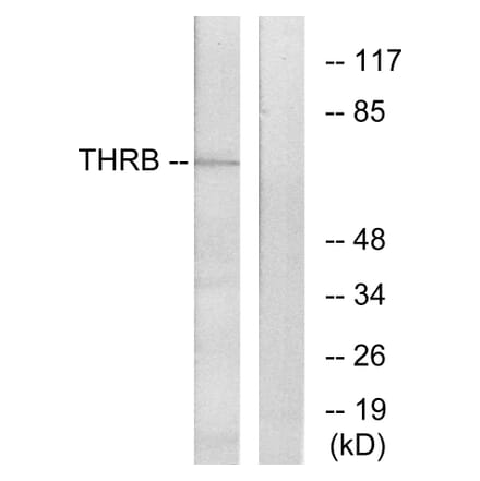 Western Blot - Anti-THRB Antibody (C10260) - Antibodies.com