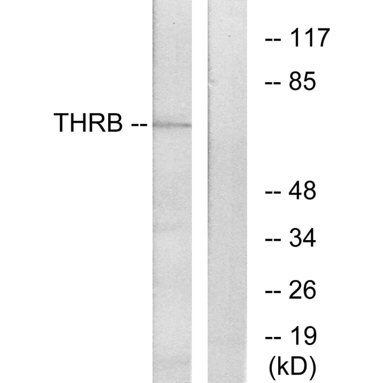 Western Blot - Anti-THRB Antibody (C10260) - Antibodies.com