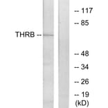 Western Blot - Anti-THRB Antibody (C10260) - Antibodies.com
