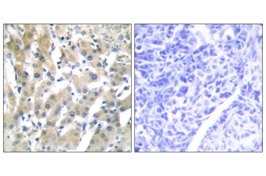 Immunohistochemistry - Anti-THRB Antibody (C10260) - Antibodies.com