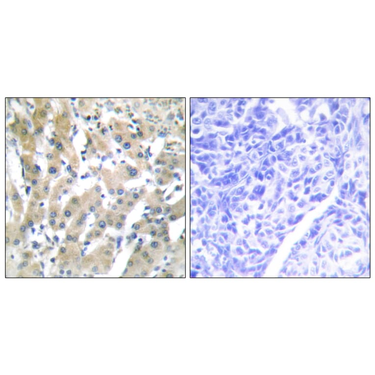 Immunohistochemistry - Anti-THRB Antibody (C10260) - Antibodies.com