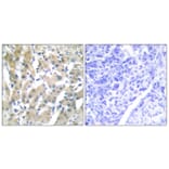 Immunohistochemistry - Anti-THRB Antibody (C10260) - Antibodies.com