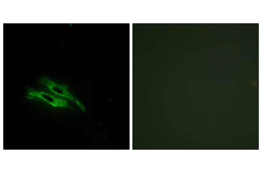 Immunofluorescence - Anti-THRB Antibody (C10260) - Antibodies.com
