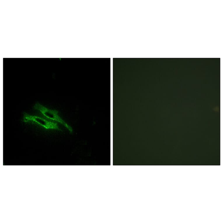 Immunofluorescence - Anti-THRB Antibody (C10260) - Antibodies.com