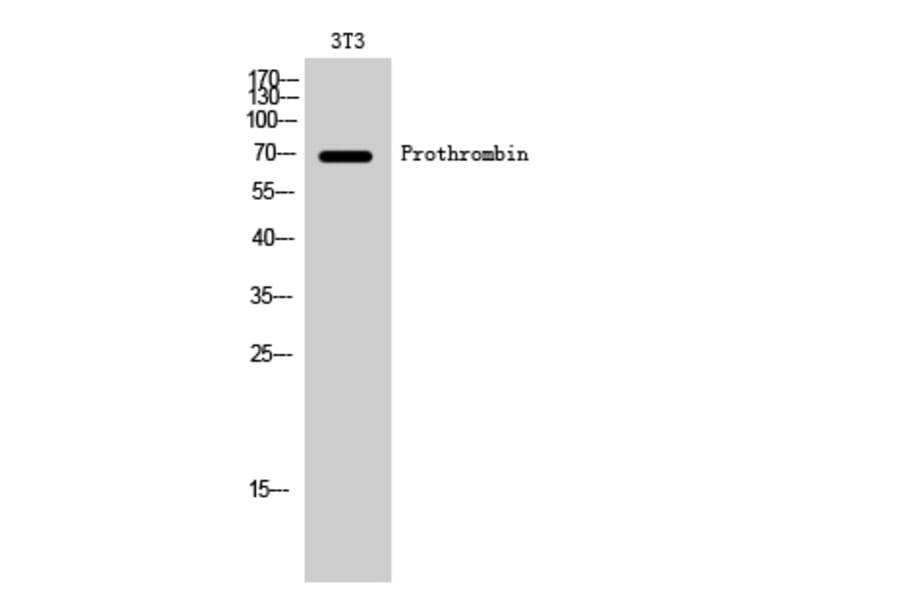 Western Blot - Anti-THRB Antibody (C10260) - Antibodies.com
