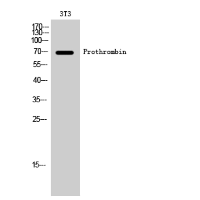 Western Blot - Anti-THRB Antibody (C10260) - Antibodies.com