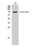 Western Blot - Anti-THRB Antibody (C10260) - Antibodies.com