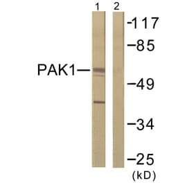 Western Blot - Anti-PAK1 Antibody (B0539) - Antibodies.com
