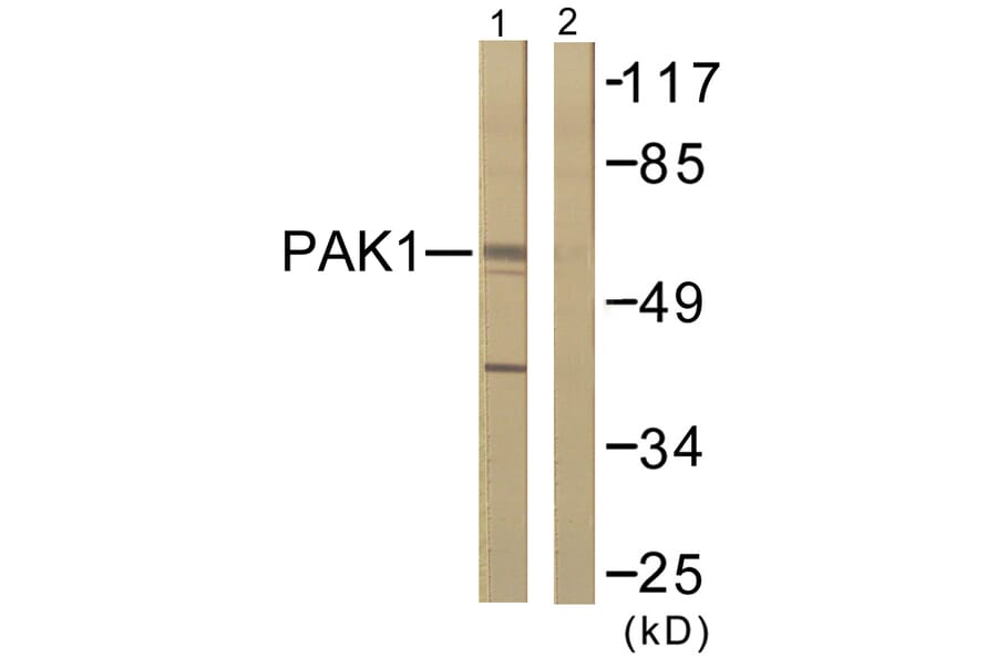 Western Blot - Anti-PAK1 Antibody (B0539) - Antibodies.com