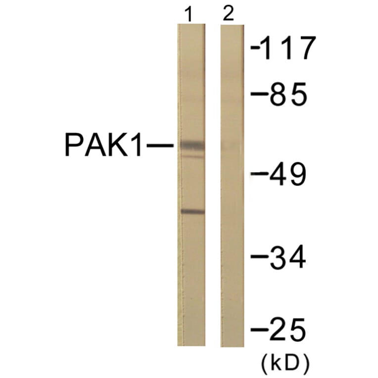 Western Blot - Anti-PAK1 Antibody (B0539) - Antibodies.com