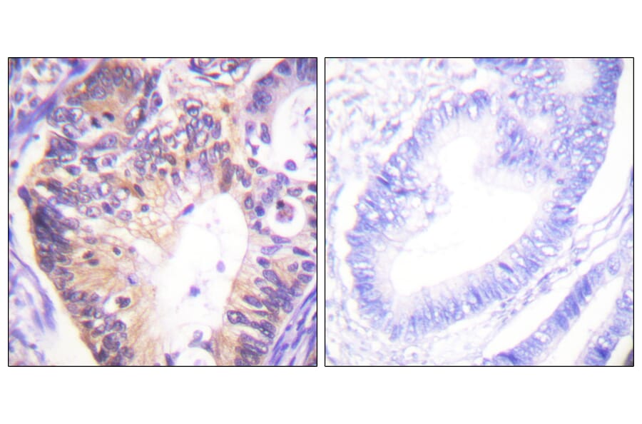 Immunohistochemistry - Anti-PAK1 Antibody (B0539) - Antibodies.com