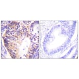 Immunohistochemistry - Anti-PAK1 Antibody (B0539) - Antibodies.com