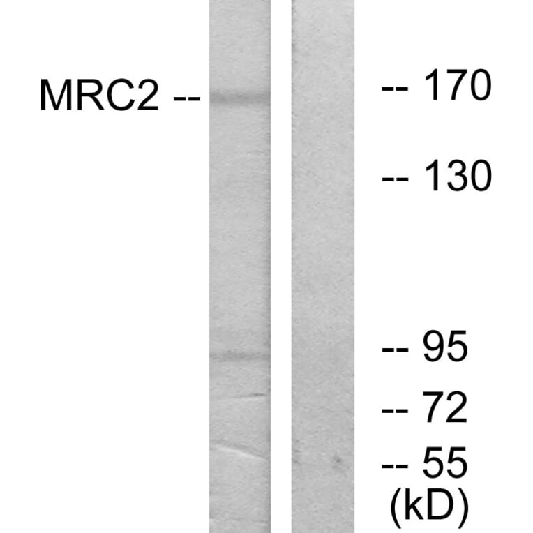Western Blot - Anti-MRC2 Antibody (C11813) - Antibodies.com
