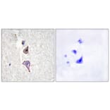 Immunohistochemistry - Anti-MRC2 Antibody (C11813) - Antibodies.com