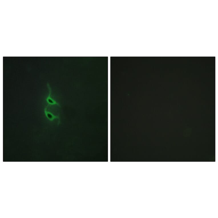 Immunofluorescence - Anti-MRC2 Antibody (C11813) - Antibodies.com