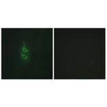 Immunofluorescence - Anti-MRC2 Antibody (C11813) - Antibodies.com