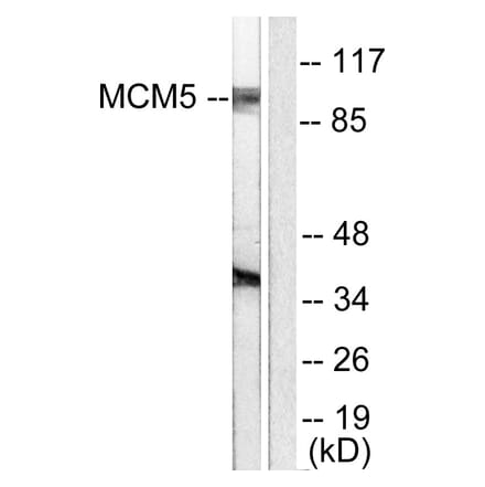 Western Blot - Anti-MCM5 Antibody (C0260) - Antibodies.com