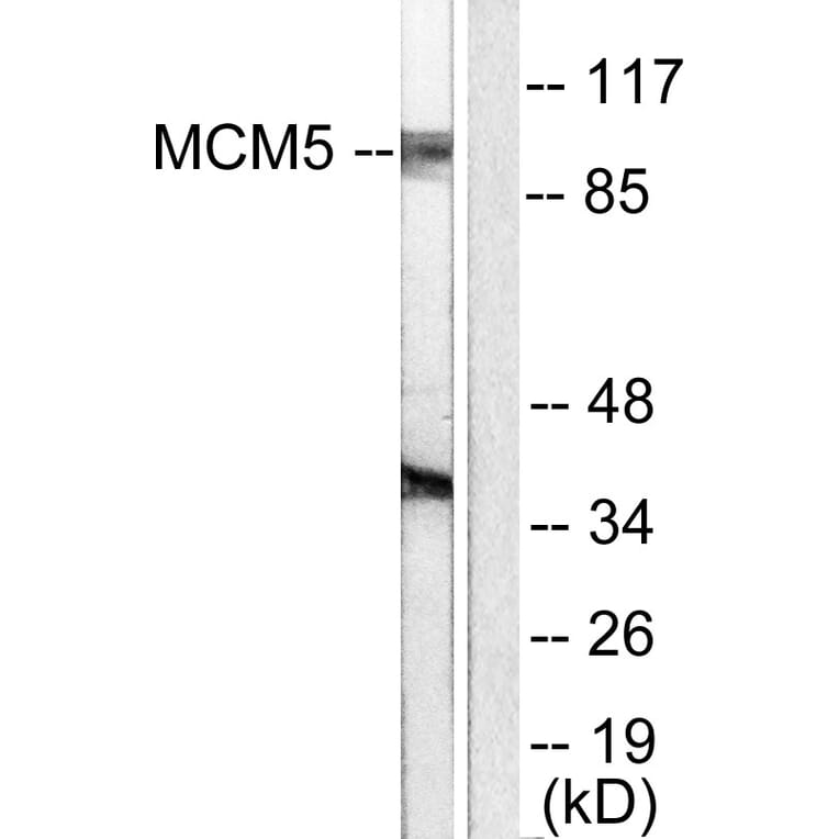 Western Blot - Anti-MCM5 Antibody (C0260) - Antibodies.com