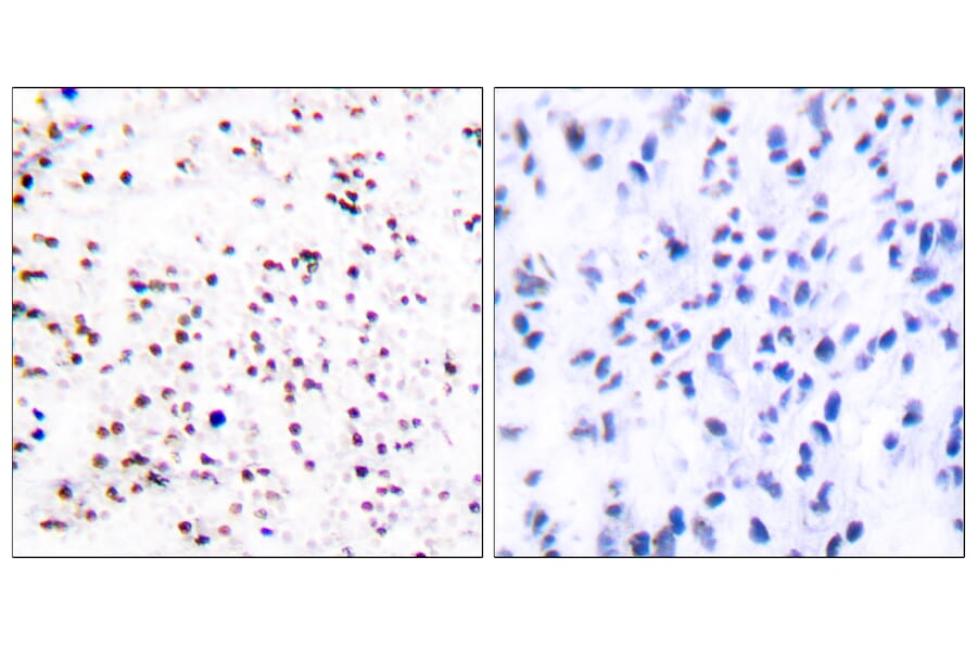 Immunohistochemistry - Anti-MCM5 Antibody (C0260) - Antibodies.com